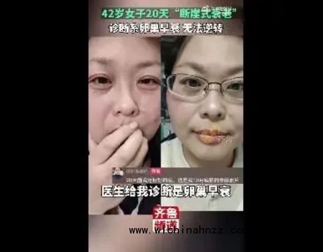 42岁断崖式衰老女子确诊卵巢早衰